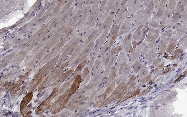 Immunohistochemistry (Formalin/PFA-fixed paraffin-embedded sections) - Anti-MYH6 antibody [3-48 G5C7] (AB207926)
