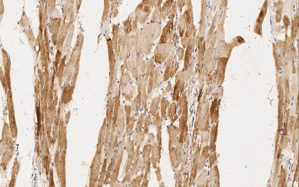 Immunohistochemistry (Formalin/PFA-fixed paraffin-embedded sections) - Anti-MYH6 antibody [3-48 G5C7] (AB207926), expandable thumbnail
