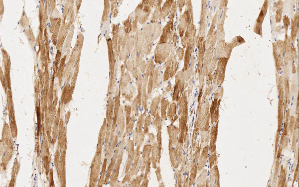 Immunohistochemistry (Formalin/PFA-fixed paraffin-embedded sections) - Anti-MYH6 antibody [3-48 G5C7] (AB207926)