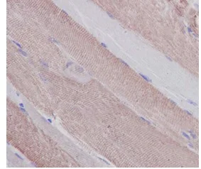 Immunohistochemistry (Formalin/PFA-fixed paraffin-embedded sections) - Anti-MYH6 + Slow Skeletal Myosin Heavy chain antibody [EPR10891(2)] (AB185967)