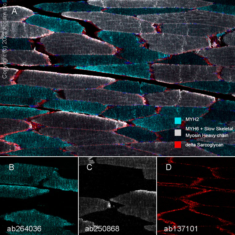 Multiplex immunohistochemistry - Anti-MYH6 + Slow Skeletal Myosin Heavy chain antibody [EPR10891(2)] - BSA and Azide free (AB250868)