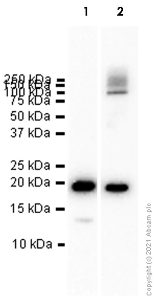 Western blot - Anti-MYH6 + Slow Skeletal Myosin Heavy chain antibody [EPR10891(2)] - BSA and Azide free (AB250868)