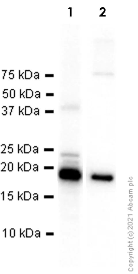 Western blot - Anti-MYH6 + Slow Skeletal Myosin Heavy chain antibody [EPR10891(2)] - BSA and Azide free (AB250868)