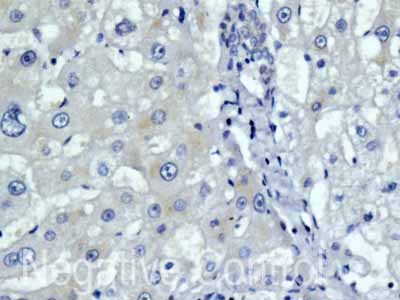 Immunohistochemistry (Formalin/PFA-fixed paraffin-embedded sections) - Anti-MYH7B antibody [EPR12290] (ab172967), expandable thumbnail