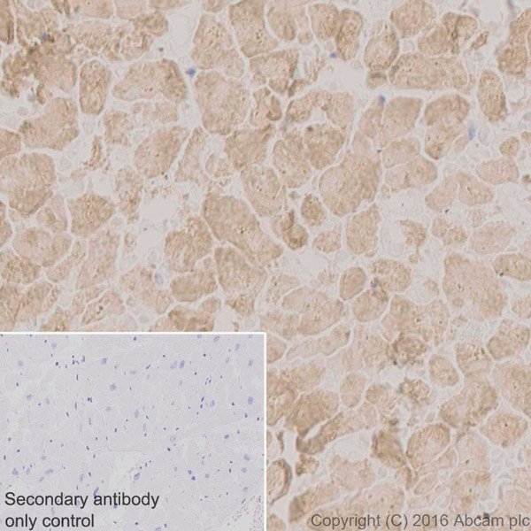 Immunohistochemistry (Formalin/PFA-fixed paraffin-embedded sections) - Anti-MYH7B antibody [EPR12290] (AB172967), expandable thumbnail