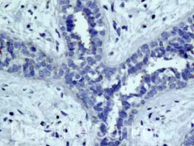 Immunohistochemistry (Formalin/PFA-fixed paraffin-embedded sections) - Anti-MYH7B antibody [EPR12290] (AB172967)