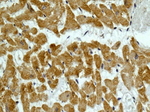 Immunohistochemistry (Formalin/PFA-fixed paraffin-embedded sections) - Anti-MYH7B antibody [EPR12290] (AB172967), expandable thumbnail