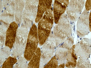Immunohistochemistry (Formalin/PFA-fixed paraffin-embedded sections) - Anti-MYH7B antibody [EPR12290] (ab172967), expandable thumbnail