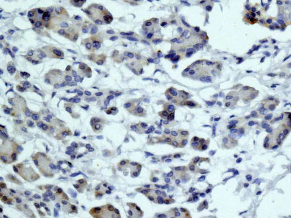 Immunohistochemistry (Formalin/PFA-fixed paraffin-embedded sections) - Anti-MYH7B antibody [EPR12290] (ab172967), expandable thumbnail