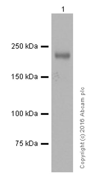 Western blot - Anti-MYH7B antibody [EPR12290] (AB172967), expandable thumbnail