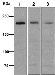 Western blot - Anti-MYH7B antibody [EPR12290] (ab172967), expandable thumbnail
