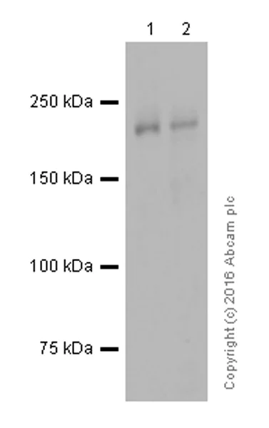 Western blot - Anti-MYH7B antibody [EPR12290] (AB172967)
