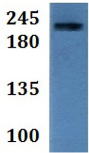 Western blot - Anti-MYH8 antibody (AB201316)