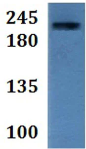 Western blot - Anti-MYH8 antibody (AB201316)