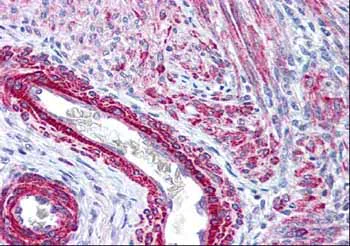 Immunohistochemistry (Formalin/PFA-fixed paraffin-embedded sections) - Anti-MYL12A (phospho S19) antibody (AB2480)