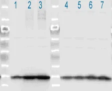 Western blot - Anti-MYL12A (phospho S19) antibody (AB2480)
