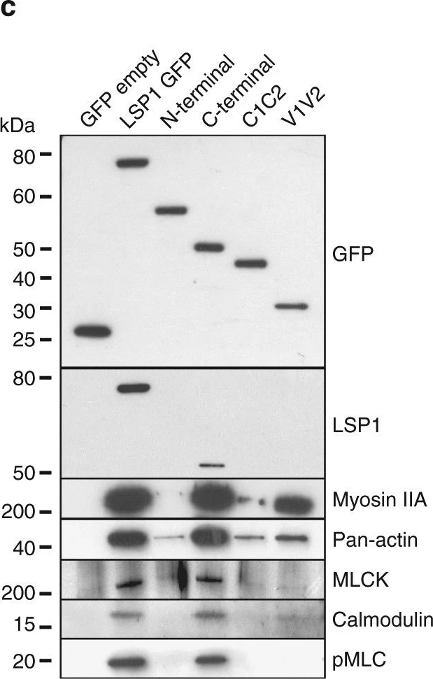 Western blot - Anti-MYL12A (phospho S19) antibody (AB2480)