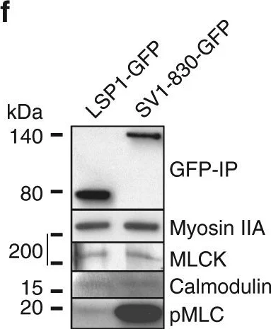 Western blot - Anti-MYL12A (phospho S19) antibody (AB2480)