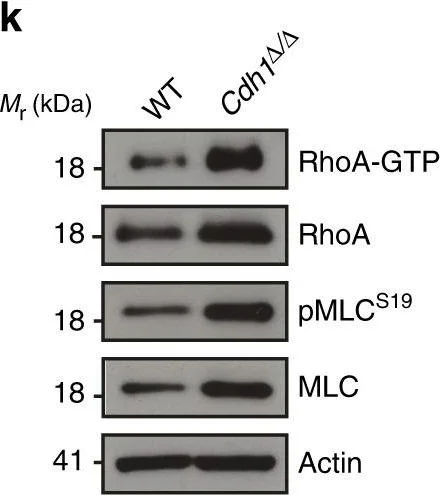 Western blot - Anti-MYL12A (phospho S19) antibody (AB2480)