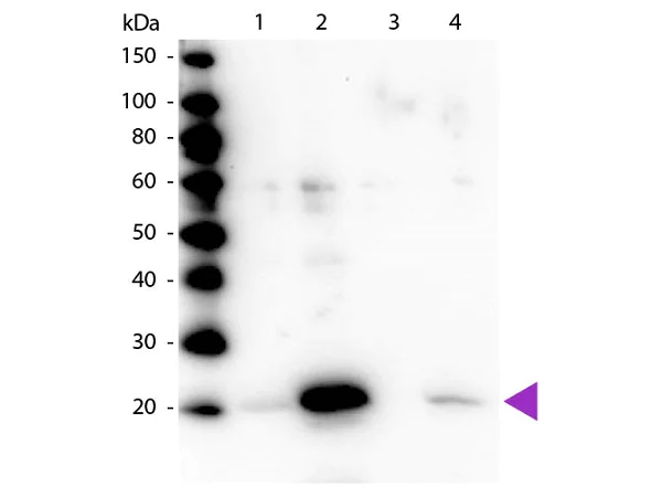 Western blot - Anti-MYL12A (phospho S19) antibody (AB2480)