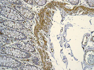 Immunohistochemistry (Formalin/PFA-fixed paraffin-embedded sections) - Anti-MYL12B antibody [EPR9331] (AB137063)