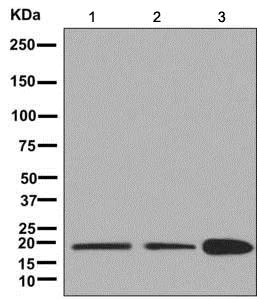 Western blot - Anti-MYL12B antibody [EPR9331] (AB137063)