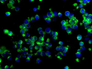 Immunocytochemistry/ Immunofluorescence - Anti-MYL12B antibody [EPR9331] - BSA and Azide free (AB248794)