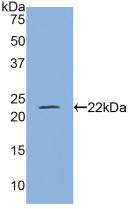Western blot - Anti-MYL4 antibody (AB231800)