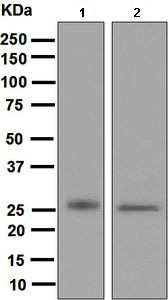 Western blot - Anti-MYL4 antibody [EPR5337] (AB133511)