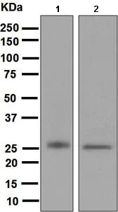 Western blot - Anti-MYL4 antibody [EPR5337] - BSA and Azide free (AB248531)