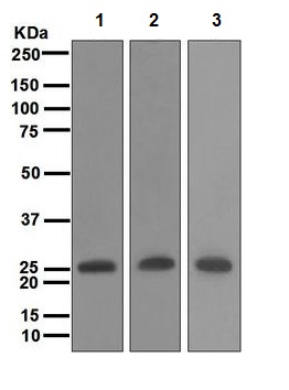 Western blot - Anti-MYL4 antibody [EPR5338] (AB108513)