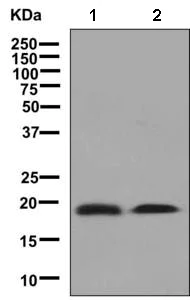 Western blot - Anti-MYL5 antibody [EPR8441] (AB139407)