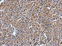 Immunohistochemistry (Formalin/PFA-fixed paraffin-embedded sections) - Anti-MYL7 antibody (AB127001)