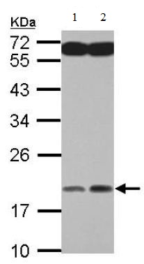 Western blot - Anti-MYL7 antibody (AB127001)