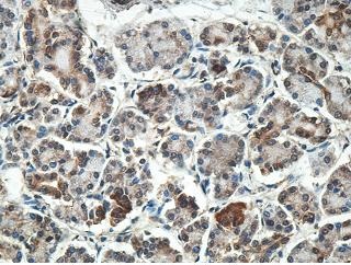 Immunohistochemistry (Formalin/PFA-fixed paraffin-embedded sections) - Anti-MYL7 antibody (AB205374)