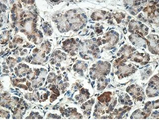 Immunohistochemistry (Formalin/PFA-fixed paraffin-embedded sections) - Anti-MYL7 antibody (AB205374)