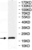 Western blot - Anti-MYL7 antibody (AB205374)