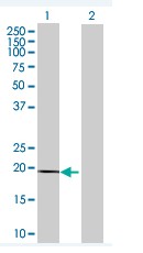 Western blot - Anti-MYL7 antibody (AB68086)