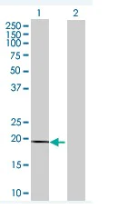 Western blot - Anti-MYL7 antibody (AB68086)