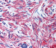 Immunohistochemistry (Formalin/PFA-fixed paraffin-embedded sections) - Anti-MYL9 antibody (AB64161), expandable thumbnail