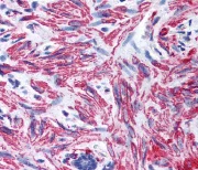 Immunohistochemistry (Formalin/PFA-fixed paraffin-embedded sections) - Anti-MYL9 antibody (AB64161)
