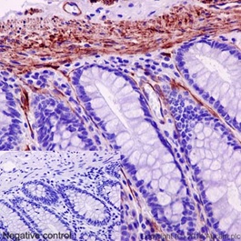 Immunohistochemistry (Formalin/PFA-fixed paraffin-embedded sections) - Anti-MYL9 antibody [EPR13012(2)] (AB191393)