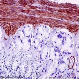 Immunohistochemistry (Formalin/PFA-fixed paraffin-embedded sections) - Anti-MYL9 antibody [EPR13012(2)] - BSA and Azide free (AB236126)