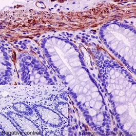 Immunohistochemistry (Formalin/PFA-fixed paraffin-embedded sections) - Anti-MYL9 antibody [EPR13012(2)] - BSA and Azide free (AB236126)