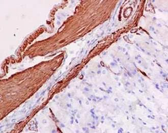 MYL9抗体[EPR13013(2)(B)] (ab187152)| Abcam中文官网