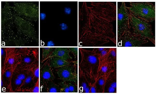 Immunocytochemistry/ Immunofluorescence - Anti-MYL9 (phospho T18 + S19) antibody [18HCLC] (AB277790)
