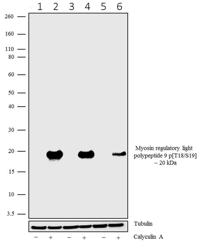 Western blot - Anti-MYL9 (phospho T18 + S19) antibody [18HCLC] (AB277790)