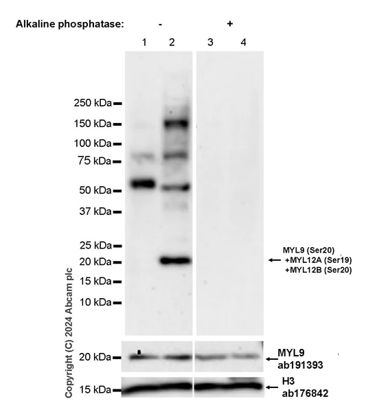 Western blot - Anti-MYL9 (pS20) + MYL12A (pS19) + MYL12B (pS20) antibody [EPR27203-65] (AB316750)