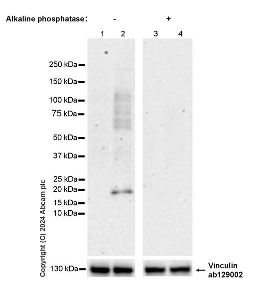 Western blot - Anti-MYL9 (pS20) + MYL12A (pS19) + MYL12B (pS20) antibody [EPR27203-65] (AB316750), expandable thumbnail