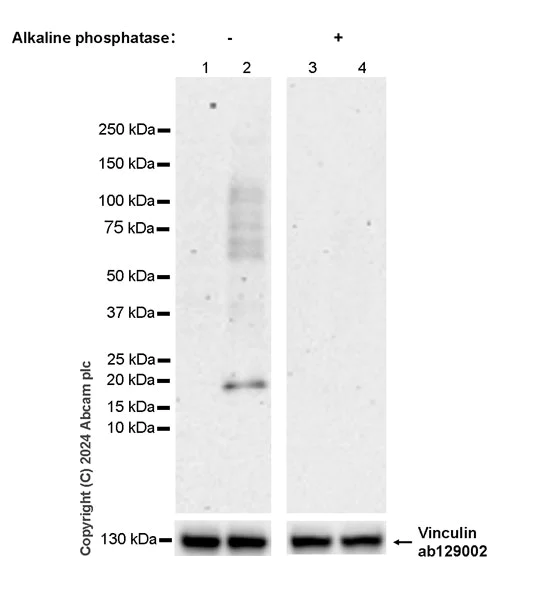 Western blot - Anti-MYL9 (pS20) + MYL12A (pS19) + MYL12B (pS20) antibody [EPR27203-65] (AB316750)
